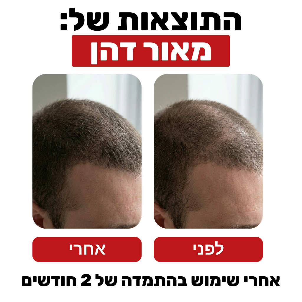 שמפו לצמיחת שיער - Venus Root Activator