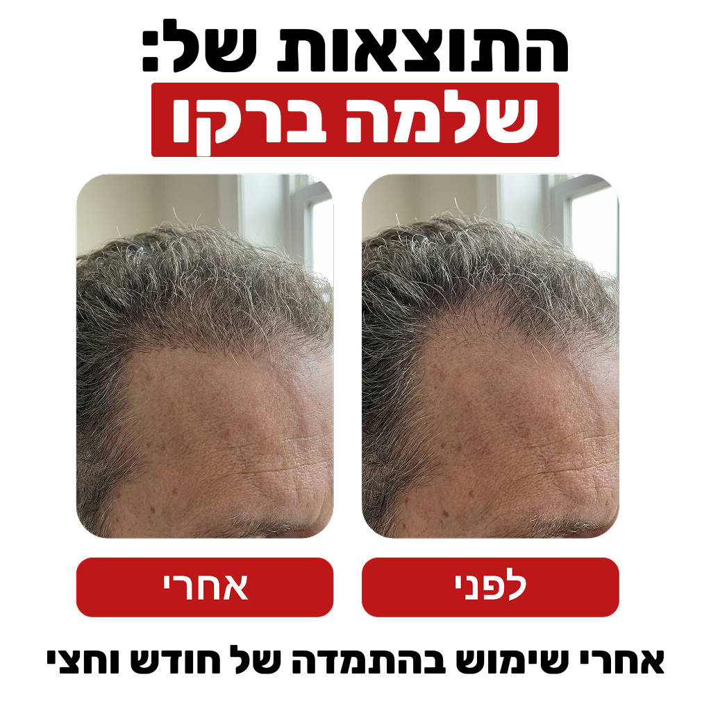שמפו לצמיחת שיער - Venus Root Activator