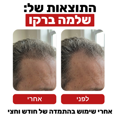 שמפו לצמיחת שיער - Venus Root Activator
