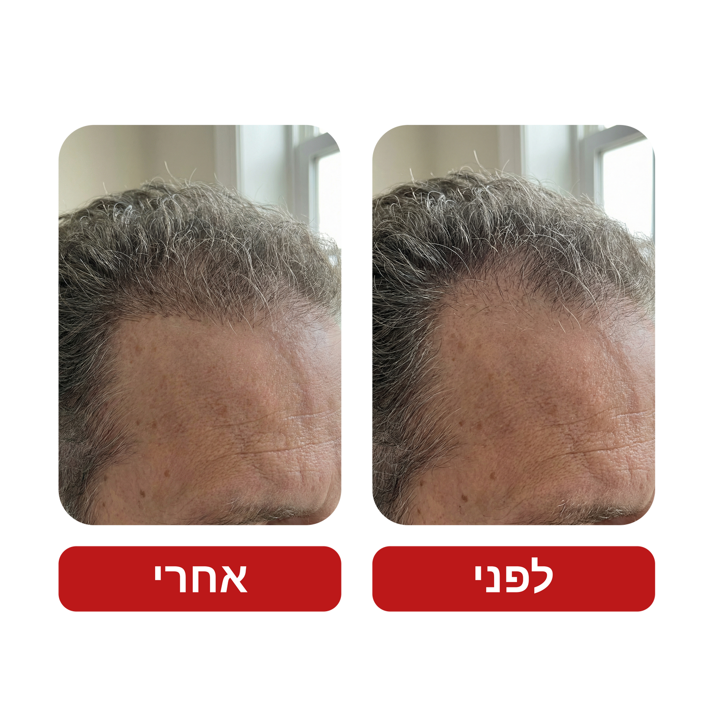 שמפו לצמיחת שיער - Venus Root Activator