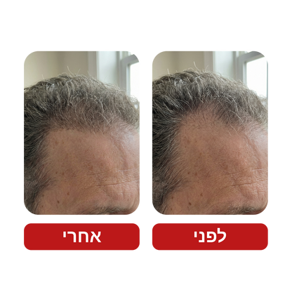Venus Root Activator - שמפו לצמיחת שיער