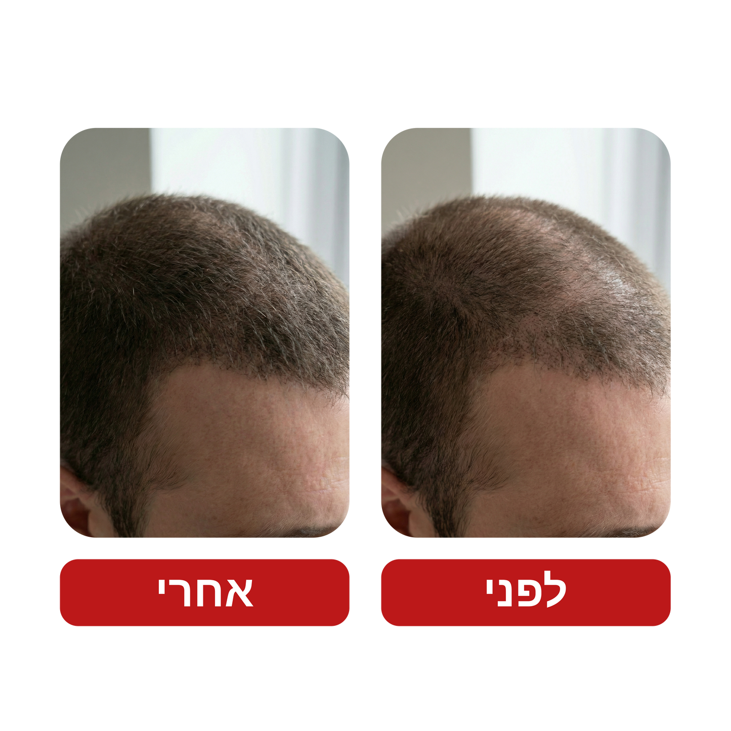 שמפו לצמיחת שיער - Venus Root Activator