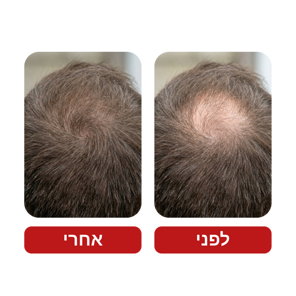 Venus Root Activator - שמפו לצמיחת שיער