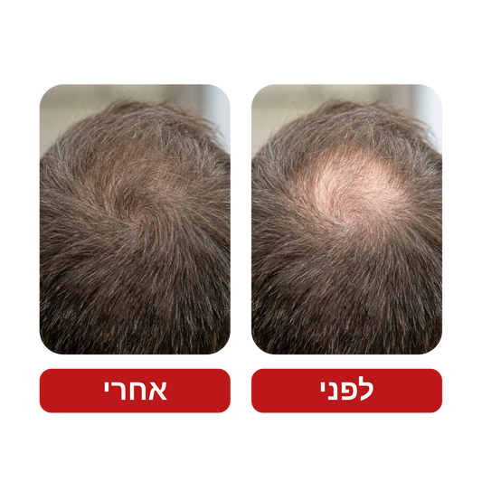 שמפו לצמיחת שיער - Venus Root Activator